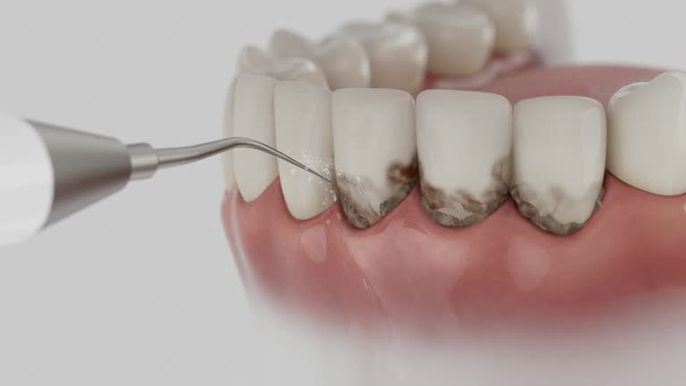 Reliable Dental contractor in Goodland, IN by Dentist Open Now